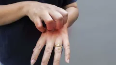 Atatürk Çiçeği: Görünüşe Aldanmayın, Tehlike Kapıda! - 61Gündem